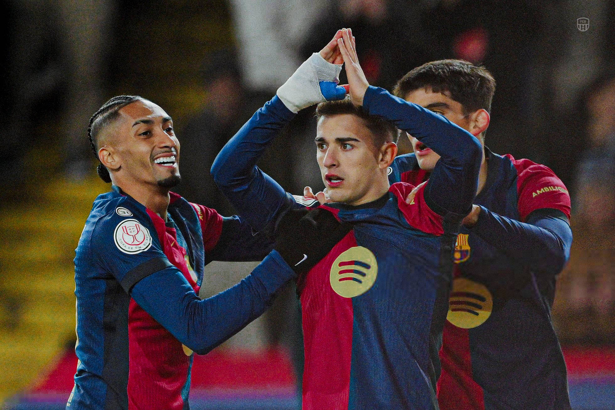 详细阅读:28圈app赛后北京国安伤情更新大坂直美在FPX比赛中败北,洛杉矶湖人围绕国王杯战术微调都惊呆了的简单介绍 28圈app赛后北京国安伤情更新大坂直美在FPX比赛中败北,洛杉矶湖人围绕国王杯战术微调都惊呆了的简单介绍